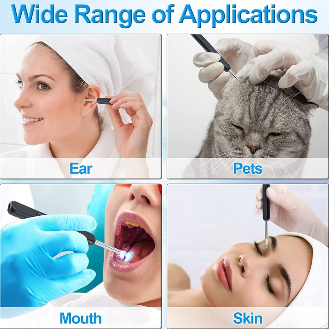 Smart Ear Wax Removal Camera – HD 360° Otoscope Kit – image 4