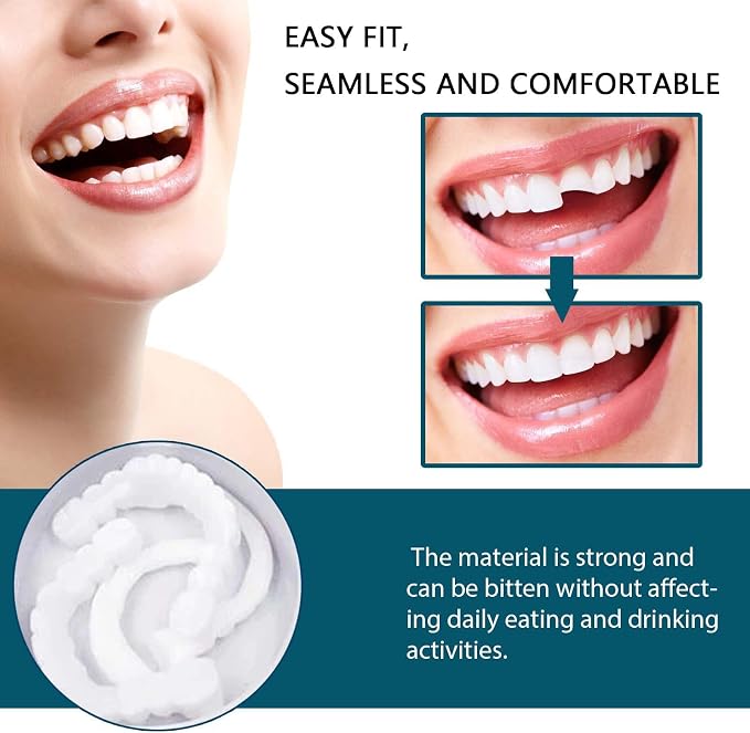 Snap On Veneers – image 2