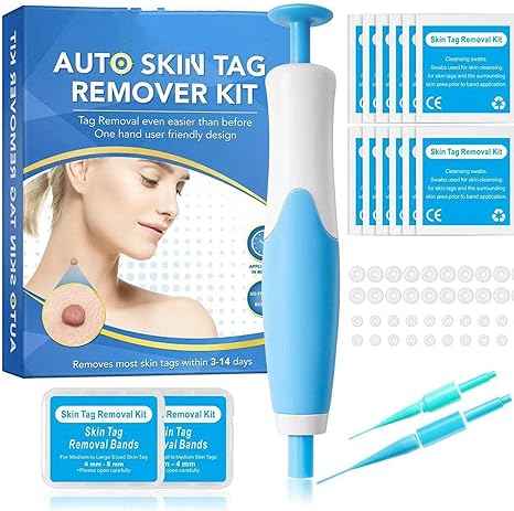 Skin Tag Remover Kit – packaging and contents
