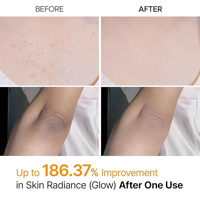 Dr. Melaxin Peel Shot Kojic Acid Body Spray – 200 ml