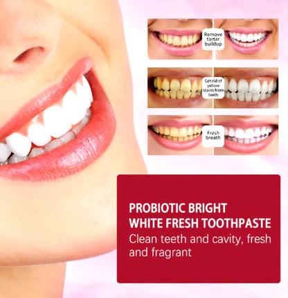 SP-4 Whitening Toothpaste – 120g Mint – image 2