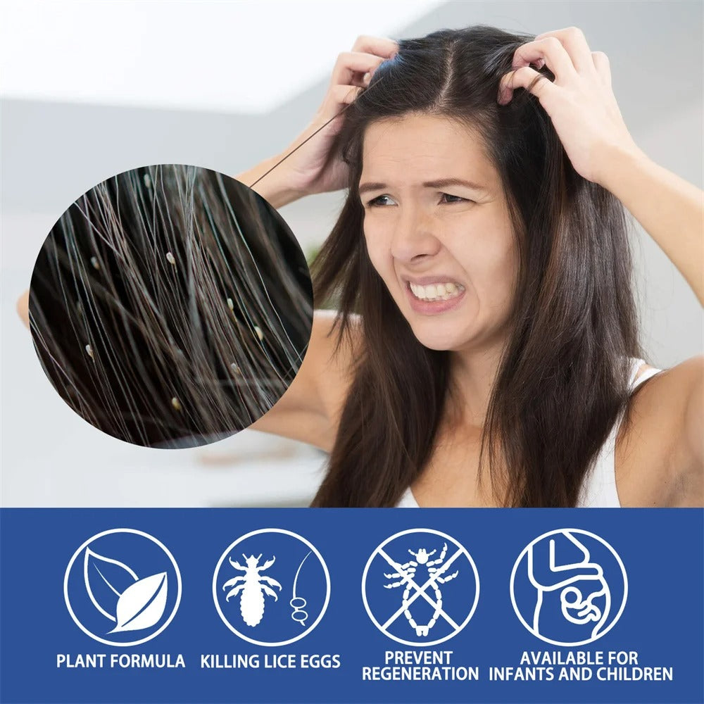 Herbal Scalp Care Spray – 30ml – image 3