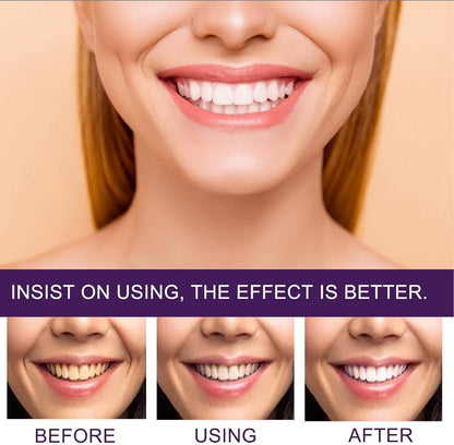 EELHOE Colour Corrector Toothpaste – 50ml – image 2