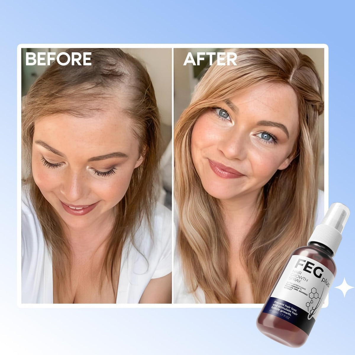 FEGPlus Minoxidil Beard and Hair Serum – image 2