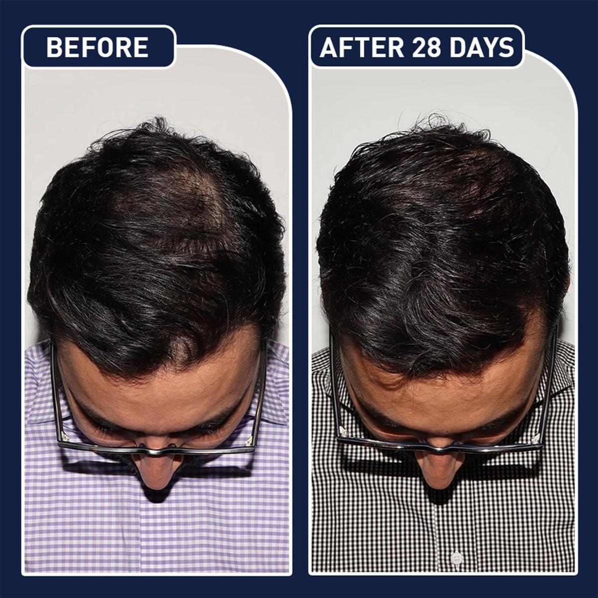 FEGPlus Minoxidil Beard and Hair Serum – image 3