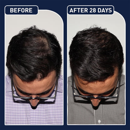 FEGPlus Minoxidil Beard and Hair Serum – image 3