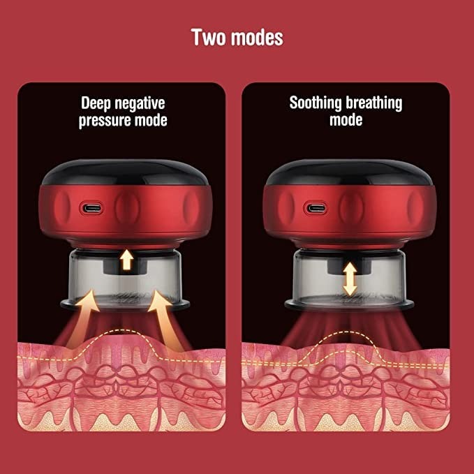Smart Cupping Massager – 12 Modes, Suction and Scraping – image 3