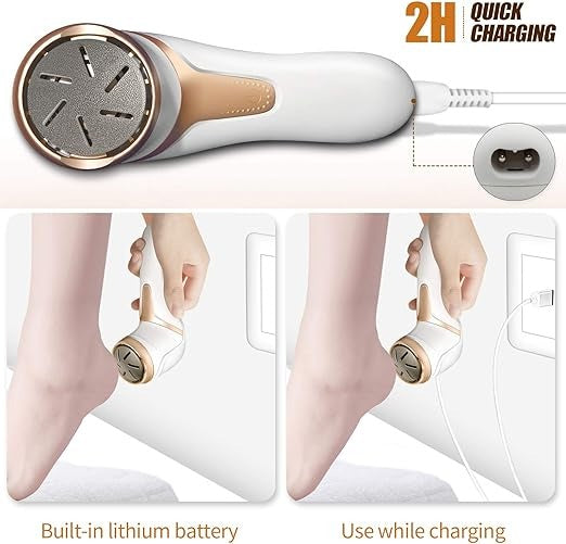 Electric Foot Callus Remover with Vacuum – Rechargeable Foot File – image 3