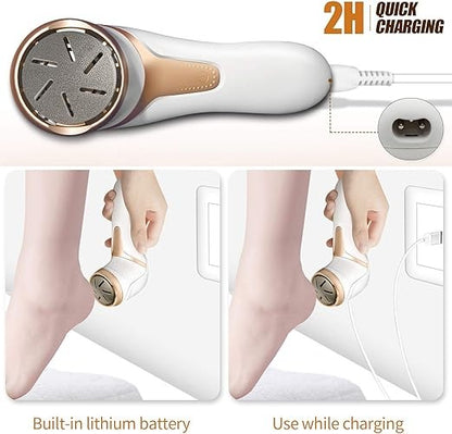 Electric Foot Callus Remover with Vacuum – Rechargeable Foot File – image 3