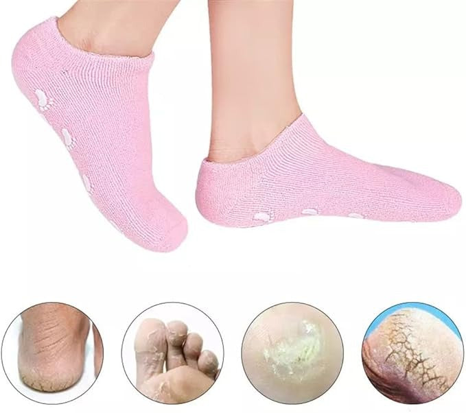 Gel Heel Socks for Dry Cracked Heels – Moisturising – image 1
