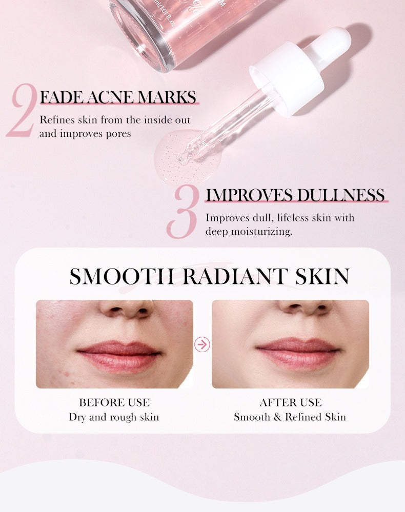 Anua Peach 70% Niacinamide Serum – 30ml – image 3