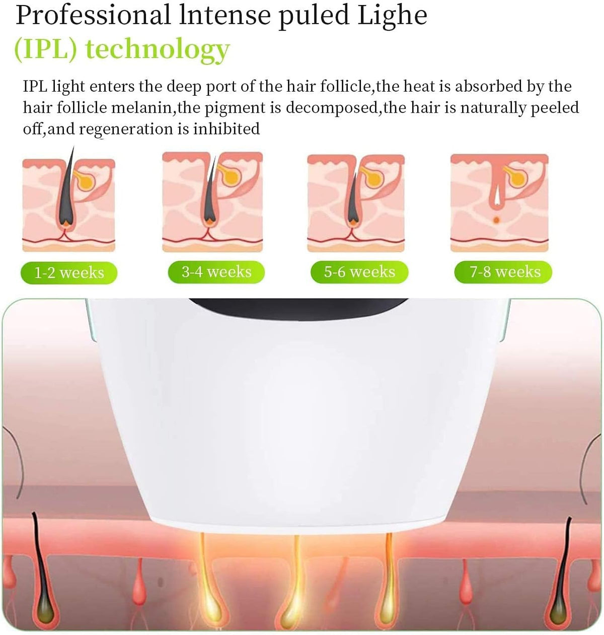IPL Hair Removal System – 5 Energy Levels, Auto Mode – image 2