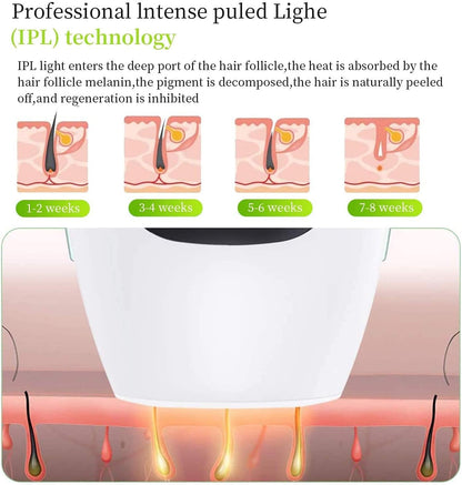 IPL Hair Removal System – 5 Energy Levels, Auto Mode – image 2