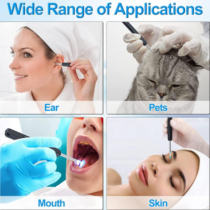 Smart Ear Wax Removal Camera – HD 360° Otoscope Kit – image 4