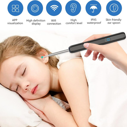 Smart Ear Wax Removal Camera – HD 360° Otoscope Kit – image 1