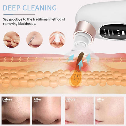 Electric Blackhead Remover Vacuum – 3 Suction Levels – image 4