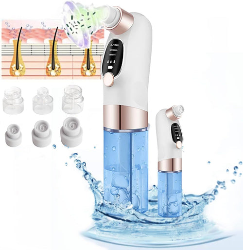 Electric Blackhead Remover Vacuum – 3 Suction Levels – image 1