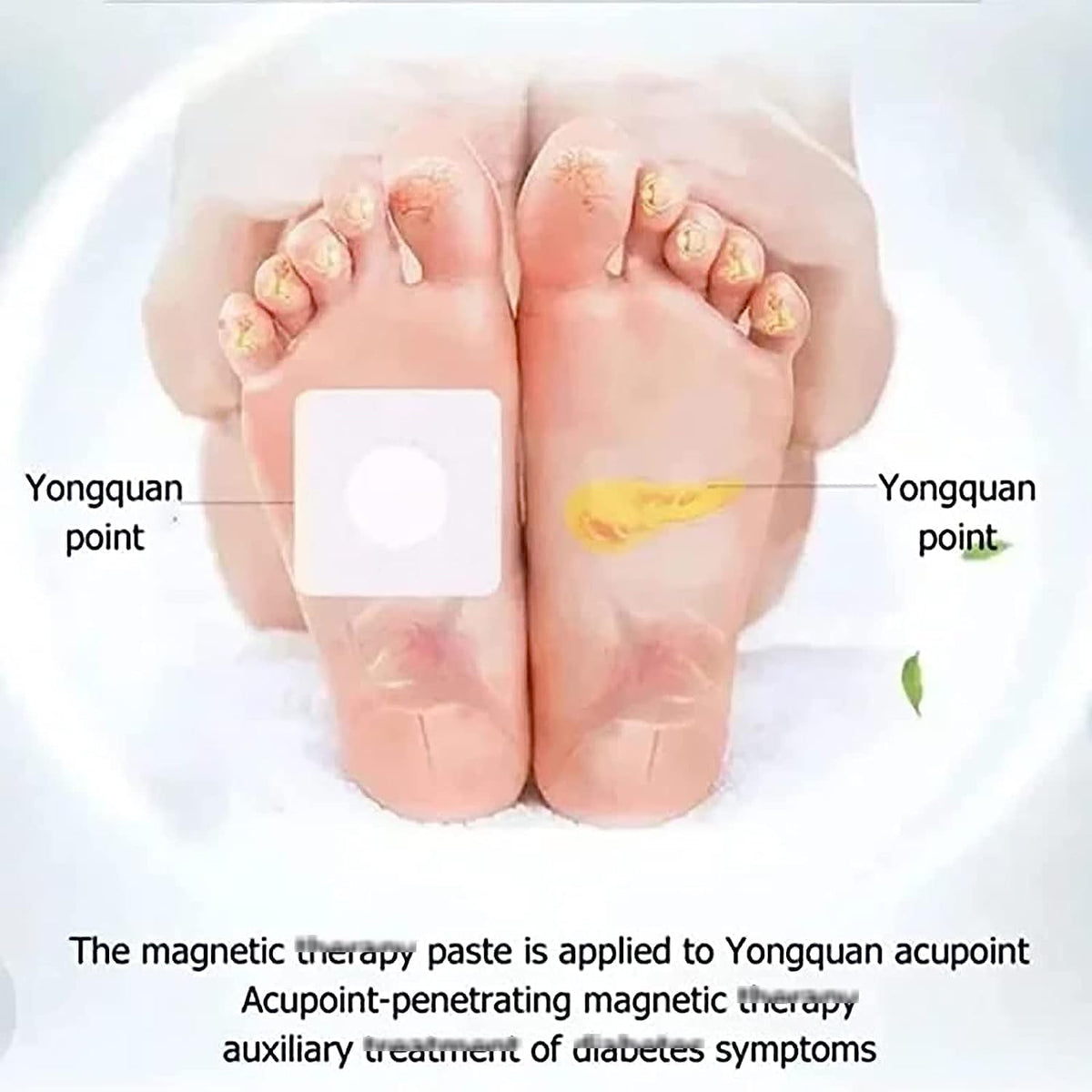 Acupoint Pressure Stickers – image 3