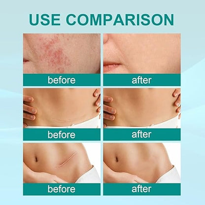 South Moon Scar Care Spray – image 1