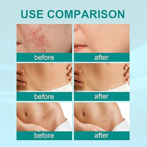 South Moon Scar Care Spray – image 1