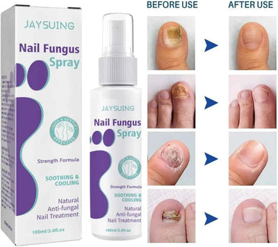 Nail Care Spray – Extra Strong, 100 ml