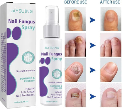 Extra Strong Nail Fungus Treatment Spray - 100ml
