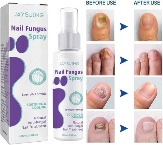 Nail Care Spray – Extra Strong, 100 ml
