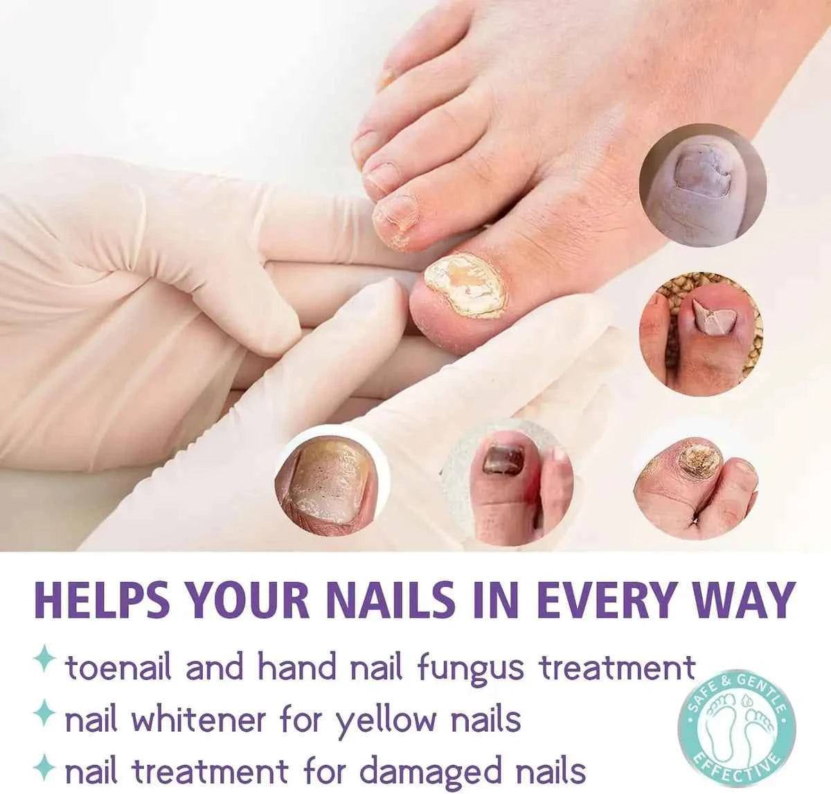 Nail Care Spray – front view