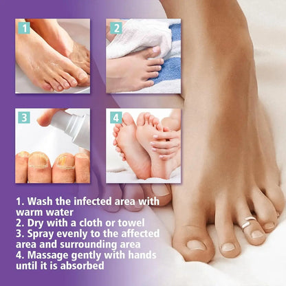 Extra Strong Nail Fungus Treatment Spray - 100ml
