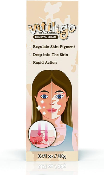 Natural Vitiligo Cream – image 1