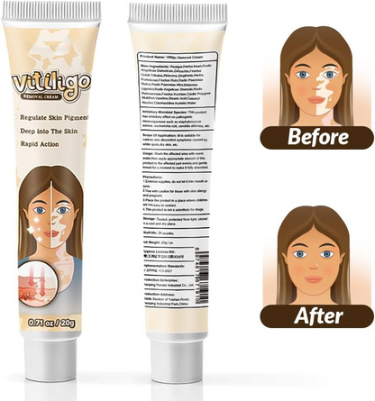 Natural Vitiligo Cream – image 3