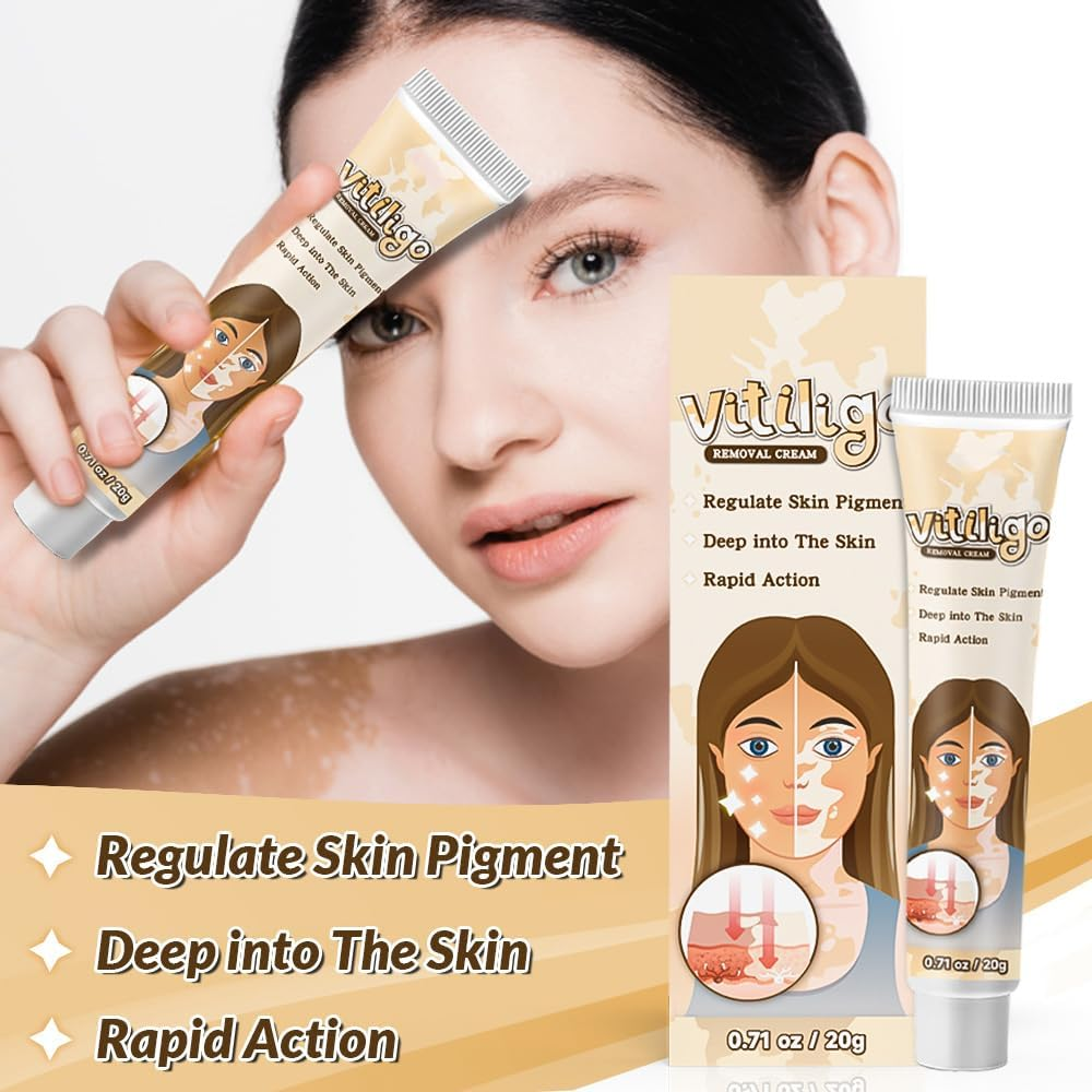 Natural Vitiligo Cream – image 4