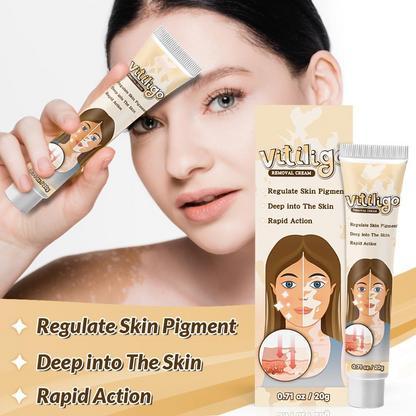 Natural Vitiligo Cream – image 4