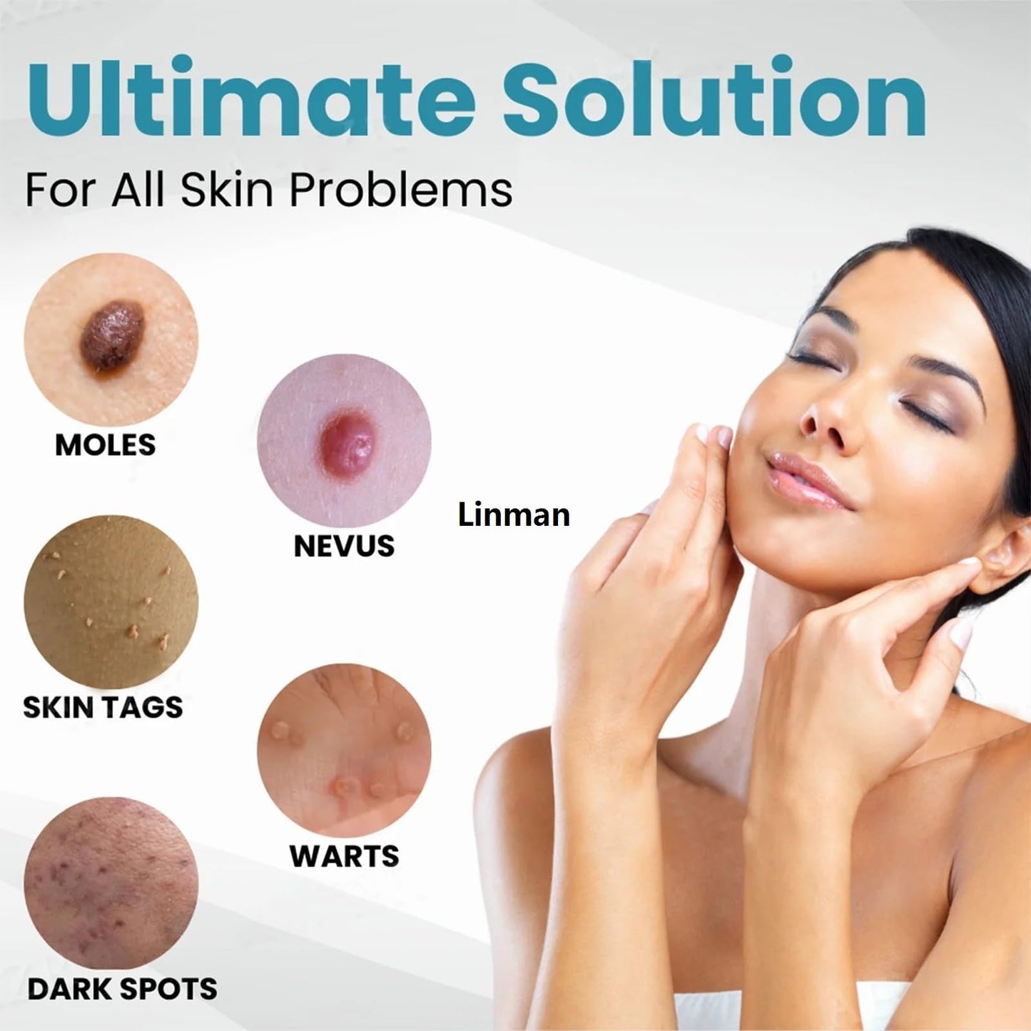 Non-Invasive Mole and Wart Removal Laser Pen (قلم ليزر لإزالة الشامات والثآليل بدون جراحة)