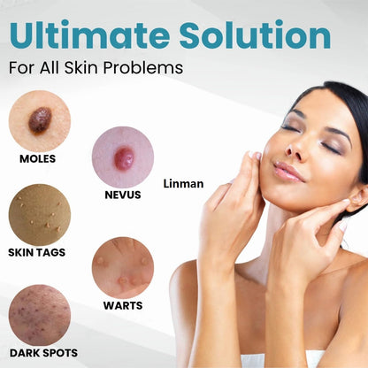 Non-Invasive Mole and Wart Removal Laser Pen (قلم ليزر لإزالة الشامات والثآليل بدون جراحة)