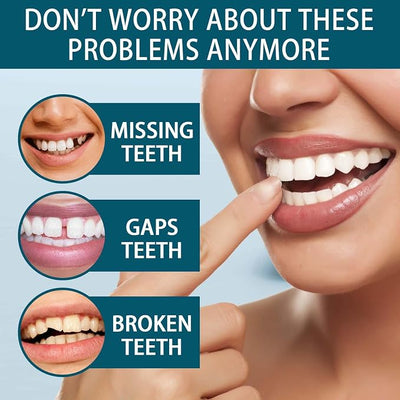 Snap On Veneers – image 1
