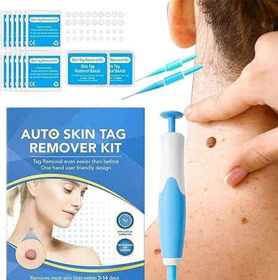 Skin Tag Remover Kit
