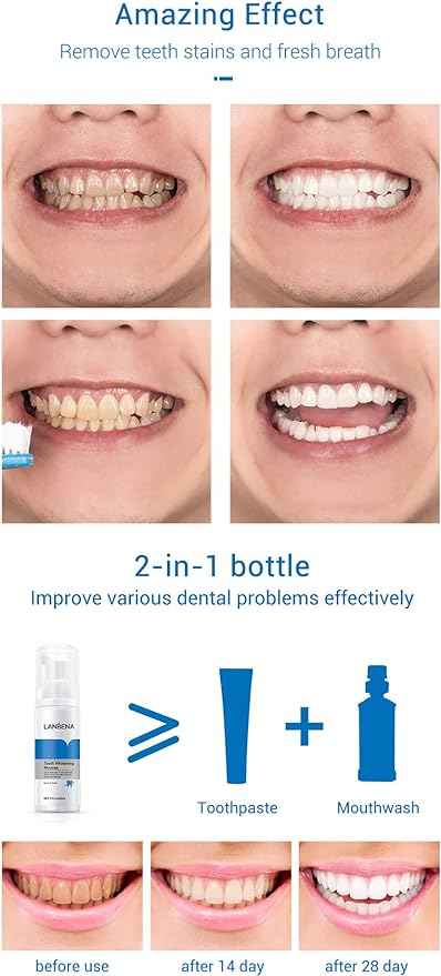 Teeth Whitening Mousse – side view