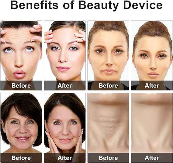 Eye Beauty Device – detail view
