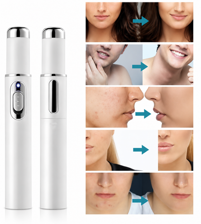 Non-Invasive Mole and Wart Removal Laser Pen (قلم ليزر لإزالة الشامات والثآليل بدون جراحة)