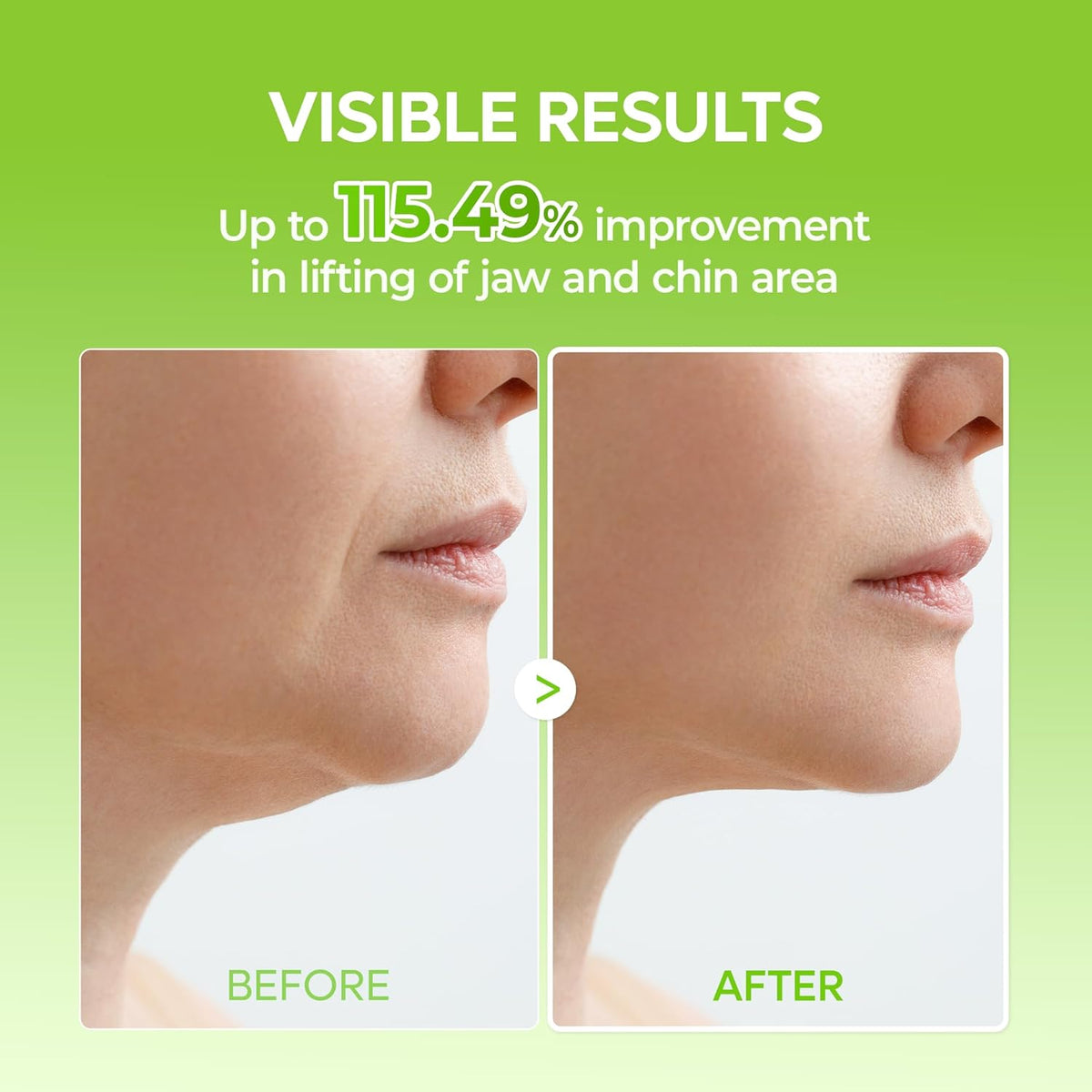 Dr. Melaxin CACTOX V-Lifting Mewing Band – 4 Masks