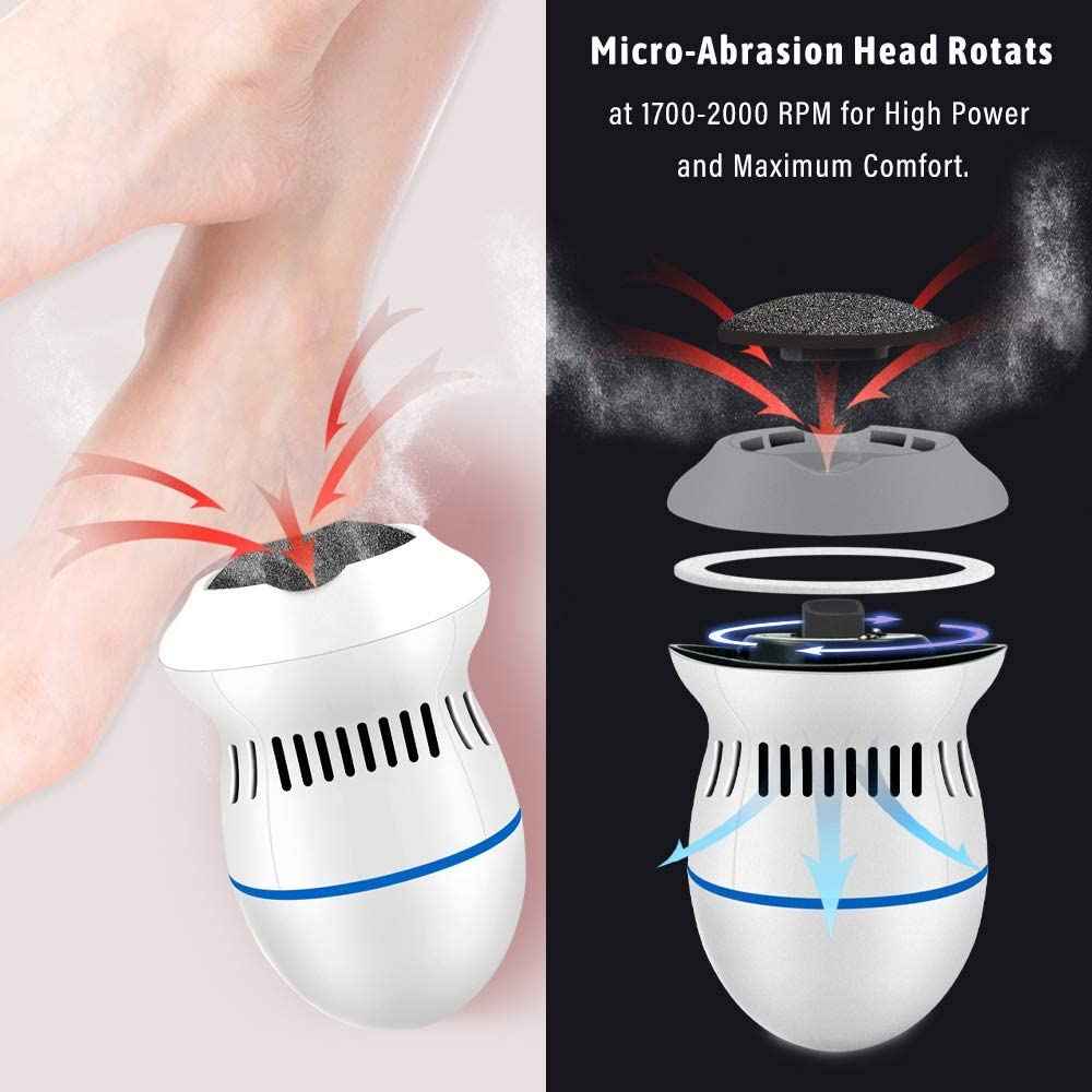 Electric Callus Remover – in use