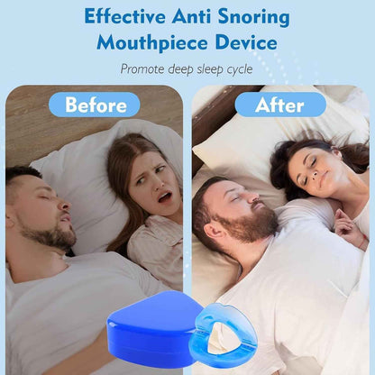 Anti-Snore Mouthpiece – Soft Reusable Silicone