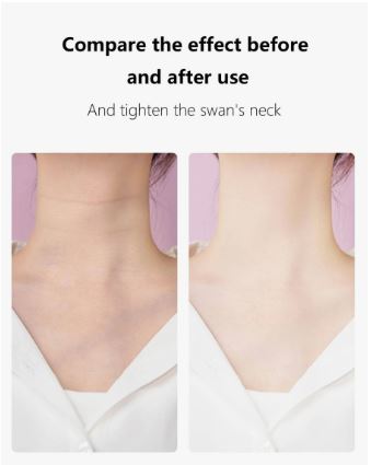 Anti Wrinkle Beauty Apparatus – in use