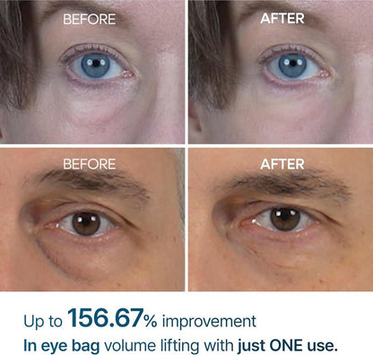 Dr. Melaxin Eyephlat Eye Cream – 10 ml