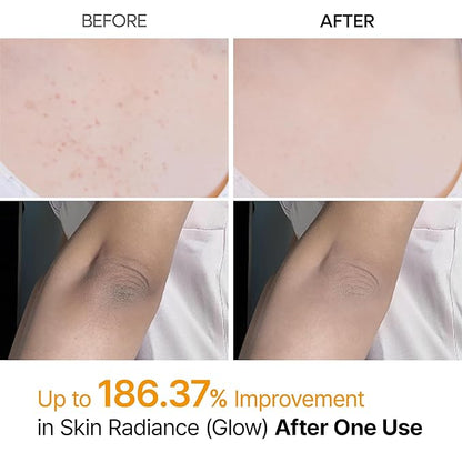 Dr. Melaxin Peel Shot Kojic Acid Body Spray – 200 ml