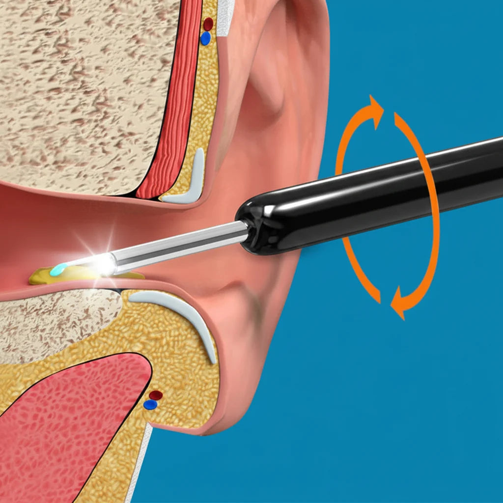 Earwax Removal Cleaning Kit | مجموعة تنظيف شمع الأذن