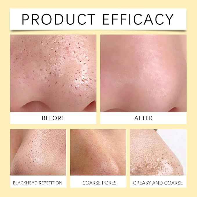Eelhoe Nose Pore Strips – 60 Strips