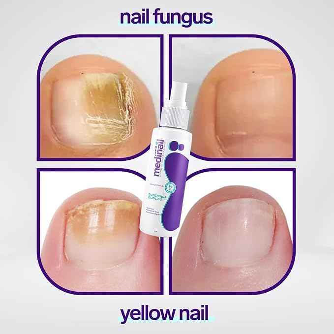 Jaysuing Nail Care Spray – 100 ml