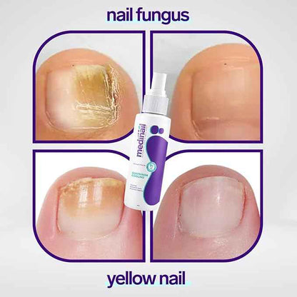 Jaysuing Nail Care Spray – 100 ml